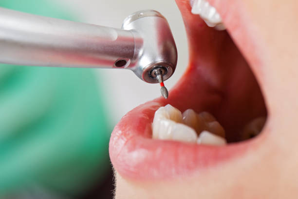Best Emergency Cosmetic Dentistry in Belle Plaine, KS
